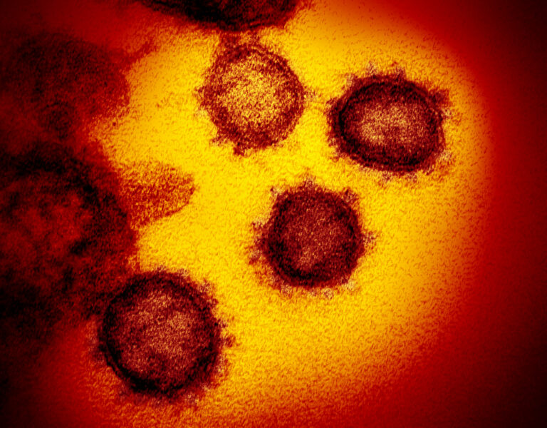 Reggeli vírusjelentés – 2020. május 13. szerda