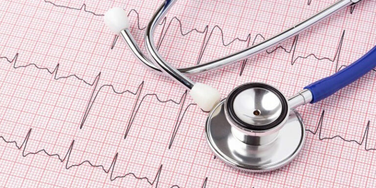 Covid után nő a szívroham, a szélütés és a szívritmuszavar kockázata